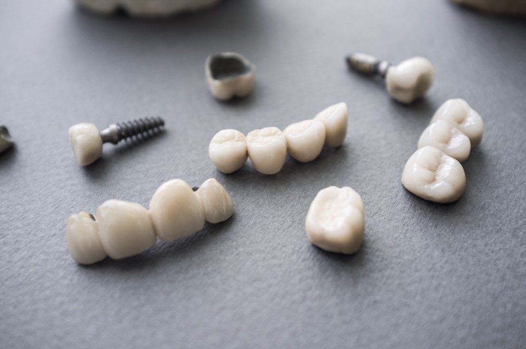 teeth for dental implants
