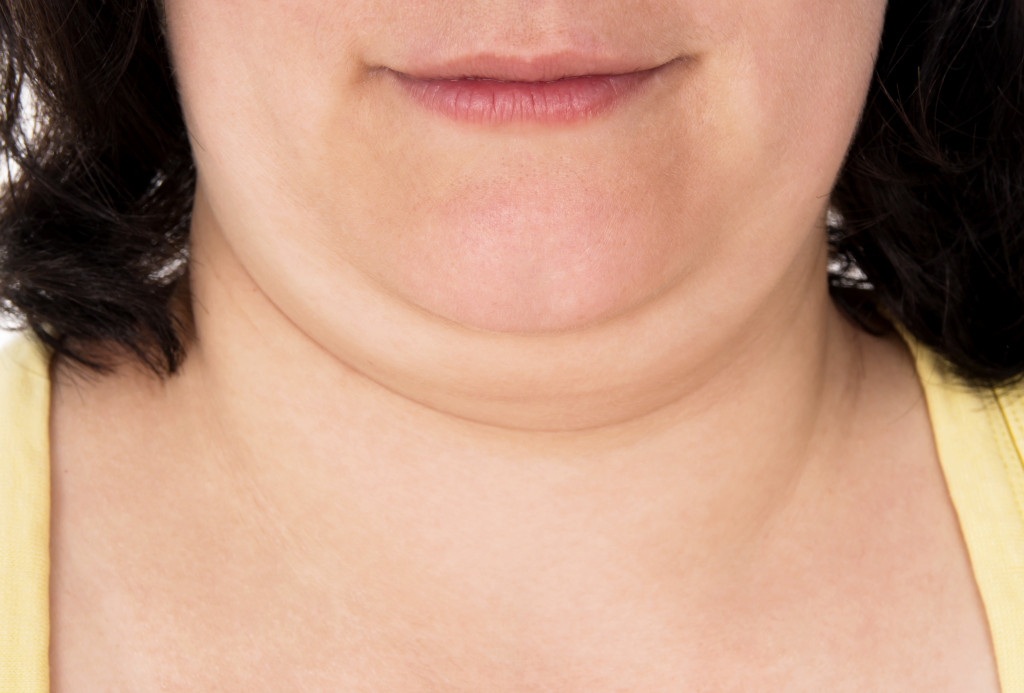 A woman with double chin